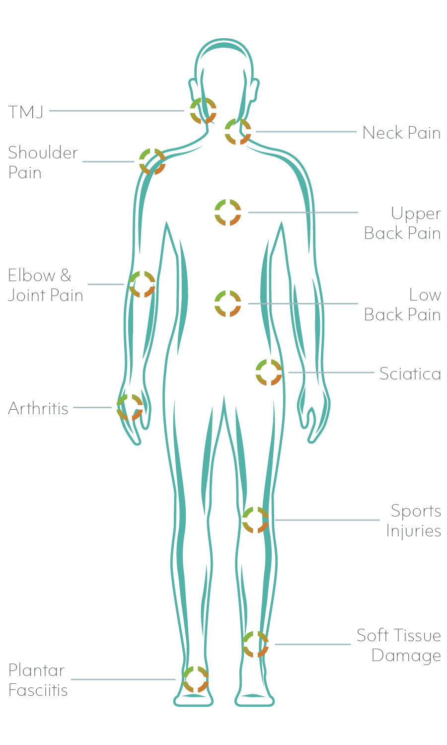 Anatomical diagram showing laser therapy treatment target areas | Freedom Chiropractic Delray Beach FL